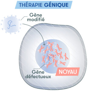 Fontionnement de la thérapie génique