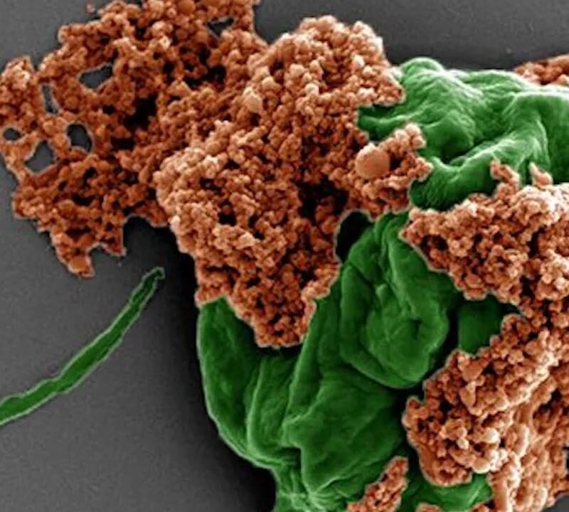 algue-microrobot-cancer