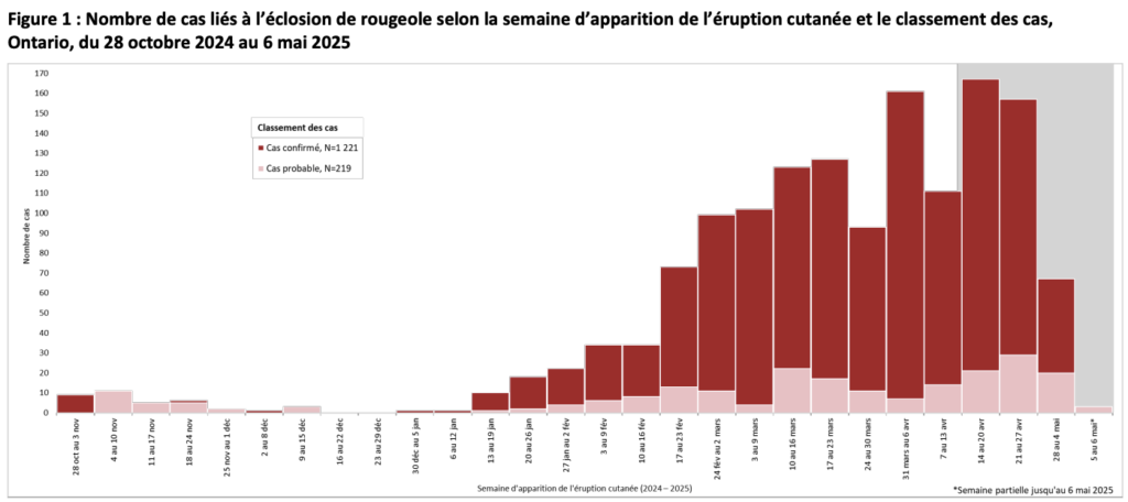 rougeole