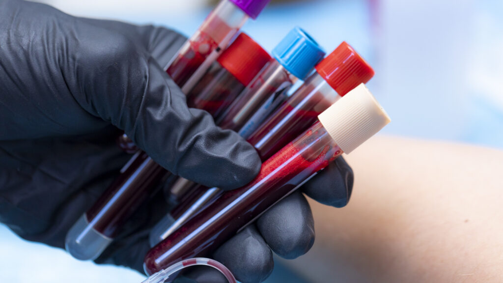 biobanques