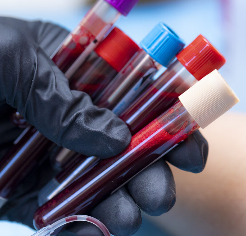 biobanques
