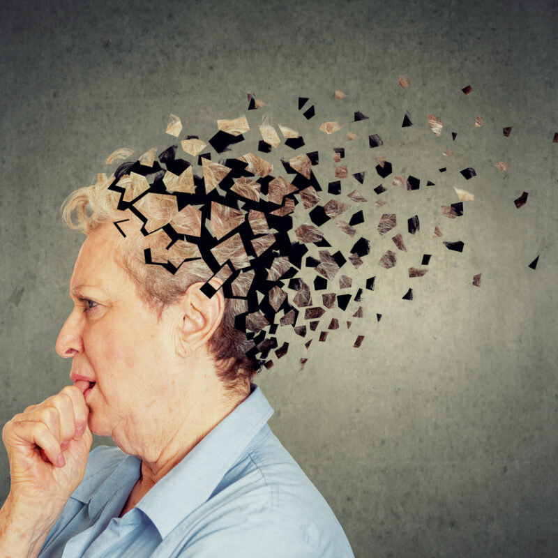 Alzheimer